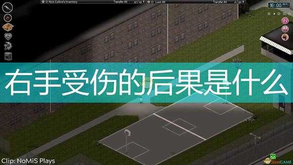 《僵尸毁灭工程》右手受伤后果介绍